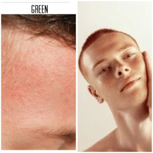 Green (skin colour corrector)